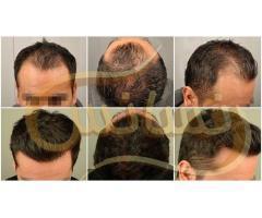 آگهی رایگان