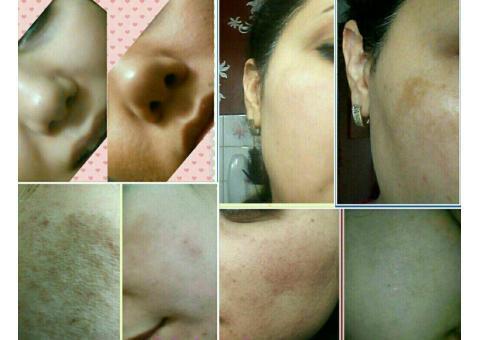 پکیج معجزه زیبایی