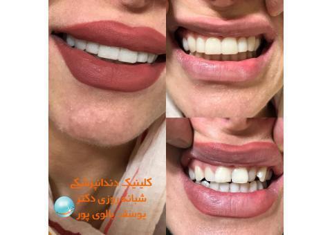 کلیه خدمات دندانپزشکی را از ما بخواهید