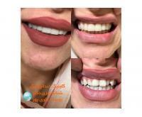 آگهی رایگان