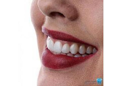 خدمات دندانپزشکی زیبایی در سعادت آباد