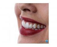 آگهی رایگان