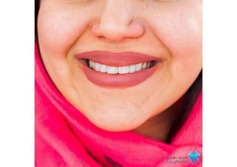 خدمات دندانپزشکی زیبایی در سعادت آباد