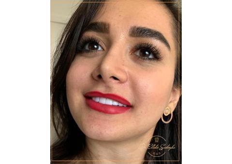 لمینت در تهران _ لمینت در شمال تهران