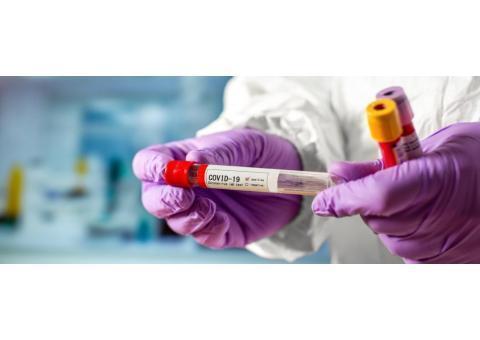 انجام تست کرونا در محل با مجوز رسمی از وزارت به
