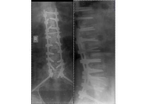 رادیولوژی و سونوگرافی در منزل(پرتابل) امید