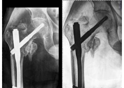 رادیولوژی و سونوگرافی در منزل(پرتابل) امید