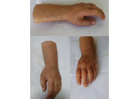 کلینیک ارتوپدی فنی بزرگمهر ساخت اعضا مصنوعی