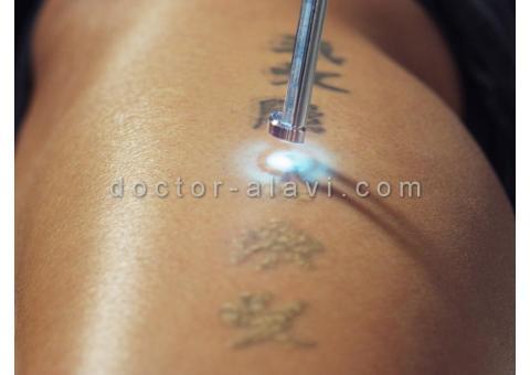 لیزر پوست شرق تهران