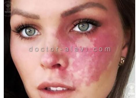 لیزر پوست شرق تهران