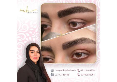 میکروبلیدینگ در شرق تهران در سالن مریم حیدری