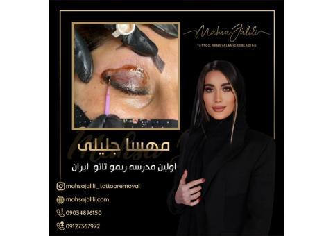 اموزش ریموو تاتو خط چشم به صورت حرفه ای