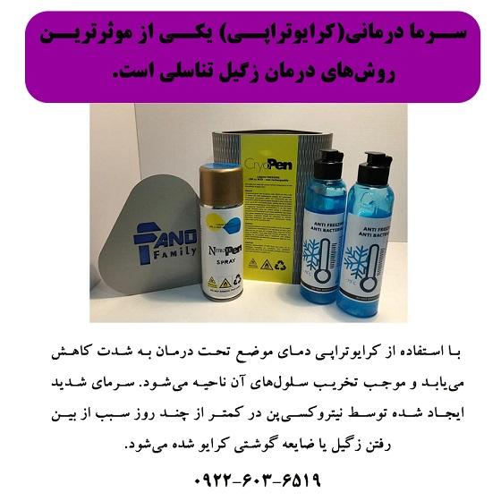 سرما درمانی روشی موثر برای درمان زگیل تناسلی