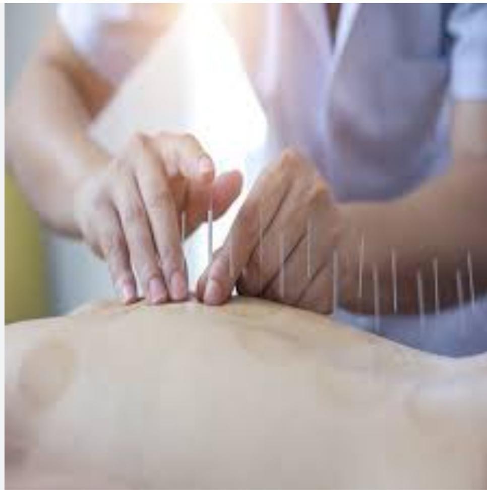 آموزش طب سوزنی، حجامت، تزریقات در مشهد
