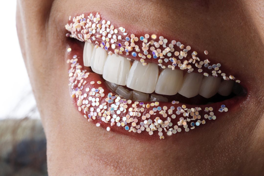 کامپوزیت ونیر در تهران