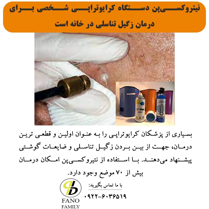 زگیل تناسلی را در خانه درمان کنید
