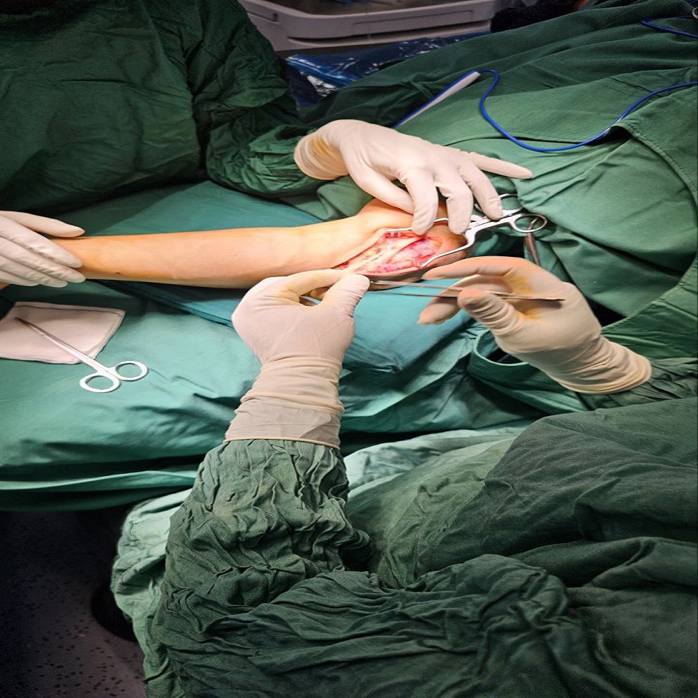 درمان شانه یخ زده