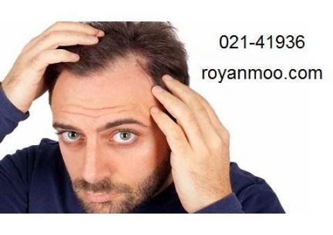 هزینه کاشت ابرو