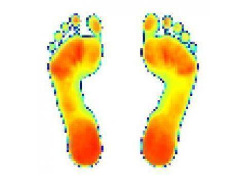 اسکن کف پا foot scan
